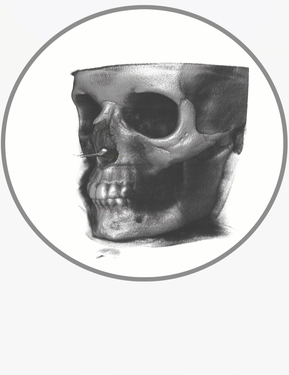 Segmentation Skull GIF