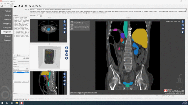 Correcting Data Bladder