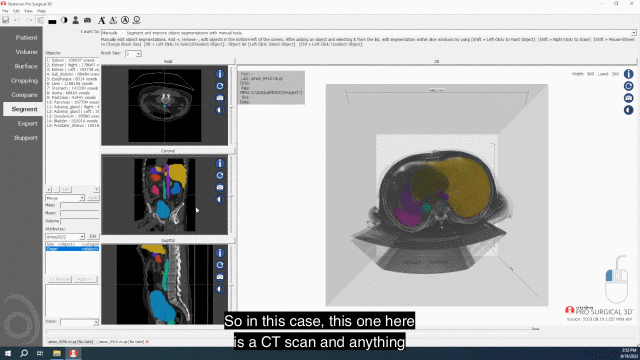 Investigating Anomalies  Multi-Organ Torso
