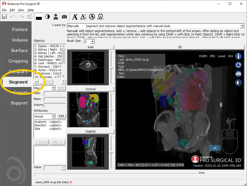 Segment Tab within Pro Surgical 3D Software