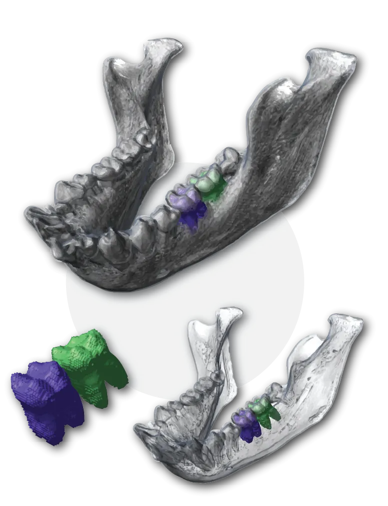 Mandible Tooth Segmentation